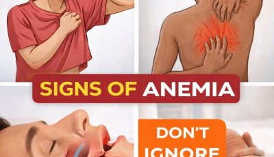 12 Silent Symptoms of Anemia You Shouldn’t Ignore