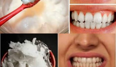 How to Naturally Whiten Your Teeth at Home in Just 3 Minutes Using Baking Soda and Coconut Oil