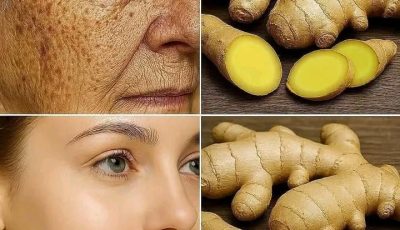 Discover the Power of Ginger for Glowing Skin