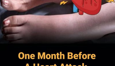 One Month Before A Heart Attack, Your Feet Will W.arn You Of These 6 Signs