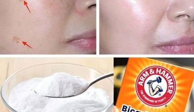 4 Ways to Erase Age Spots with Baking Soda for Younger, More Even Skin