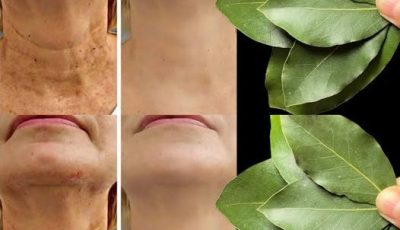 Bay Leaf Is 100,000 Times Stronger Than Botox? | Natural Wrinkle Eraser Even at Age 70!