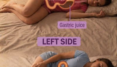 RIGHT SIDE Esophagus Stomach mach Gastric juice LEFT SIDE Gastric juice