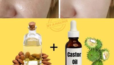 Castor Oil + Sweet Almond Oil for Wrinkles