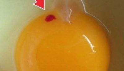 Should We Eat Eggs With BL00D Spots?