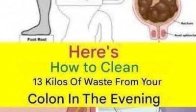 How to Clean Your Colon and Remove Waste Naturally