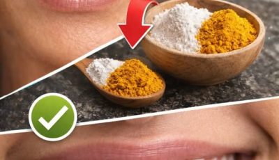 Turmeric and Baking Soda: The Natural Remedy That Cleans, Whitens, and Protects Your Teeth