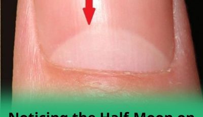 Noticing the Half-Moon on Your Nails? Here’s What It May Mean for Your Health