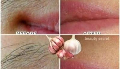 Say goodbye to undesired hair using garlic.