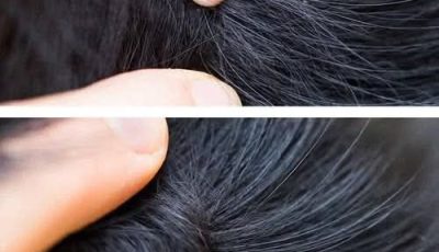 Just Discovered This in My Son’s Hair — What Is It? Should We Go to the Doctor?