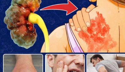 9 Warning Signs Your Kidneys Are Failing in Children