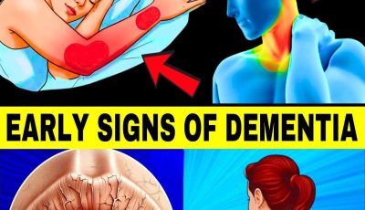 10 Early Signs of Dementia You Should NEVER Ignore!