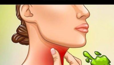 The Real Causes of Constant Phlegm and Mucus in the Throat — and How to Get Rid of It