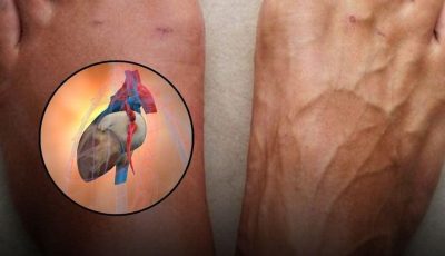 One Month Before a Heart Attack, Your Body Will Warn You of These 7 Signs