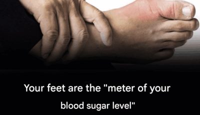 Here are five unusual foot symptoms