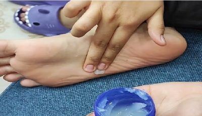 7 benefits of Vicks Vaporub
