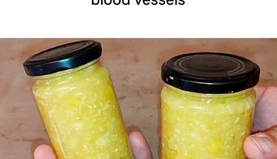 Cholesterol as if it never existed: A natural remedy to clean bl00d vessels.