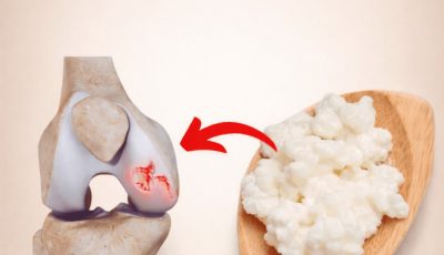 Top 10 foods to heal knee pain and boost cartilage