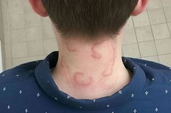 My 8 year old son been having this for 2 months straight it’s gotten worse from the first time he had this.. What is it