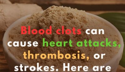 7 powerful blood-thinning foods you need to know about