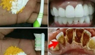 Home Teeth Whitening: Get Whiter Teeth in Just 2 Minutes!