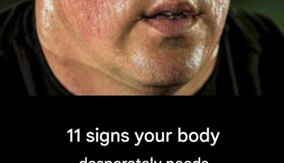 11 Signs Your Body Desperately Needs Vitamin D