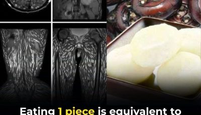 Eating Just One Bite Can Be Harmful: How to Protect Yourself from Foodborne Parasites
