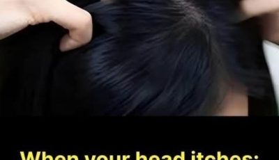 When Your Head Itches, Your Body Is Sending You a Message