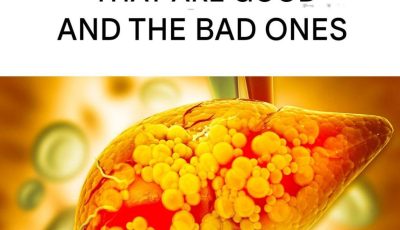Fatty Liver and Healthy Eating: Harmful Foods and Those That Help