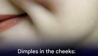 Dimples in the cheeks: why do some people have them and others don’t?