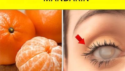 This happens if you eat tangerines.