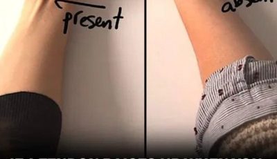 What It Means If You Have That Tendon in Your Wrist (And Why Some People Don’t)