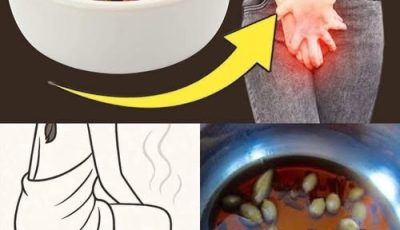 11 Incredible Clove Benefits Every Woman Should Know
