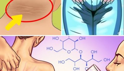 8 Signs That Indicate You Have Too Much Sugar (And What to Do About It)