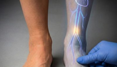 What your feet could be telling you about the health of your arteries