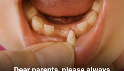 Tiny Teeth, Big Possibilities: The Promise of Stem Cells in Baby Teeth