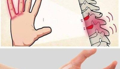 If your HANDS fall asleep it’s a clear sign that you might have… See more👇
