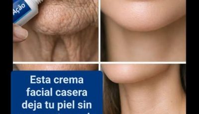 Aplica 5 Gotas De Aceite De Coco Y Borra Arrugas En 2 Semanas