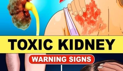 9 Warning Signs Your Kidneys Are Failing | Tests to Avoid Dialysis
