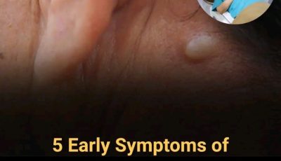 5 Warning Signs of Thyroid Cancer You Shouldn’t Ignore