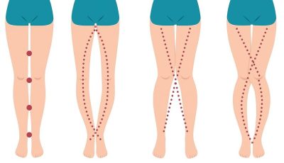THE LEGS OF A WOMAN CAN SAY AS IT IS THEIR VAGIN…