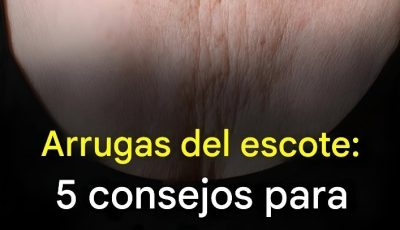 Arrugas del escote: 5 consejos para prevenirlas y eliminarlas