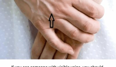 If you see a mole with visible scars, you should tell them this.
