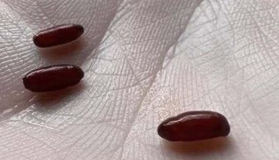 A Family’s Warning After a Sudden, Devastating Tick-Borne Illness