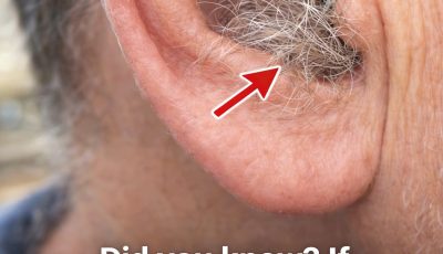 Ear Hair and Your Health: What Doctors Say About This Overlooked Body Sign