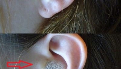 Three drops are enough to get rid of dirt and debris from your ears.